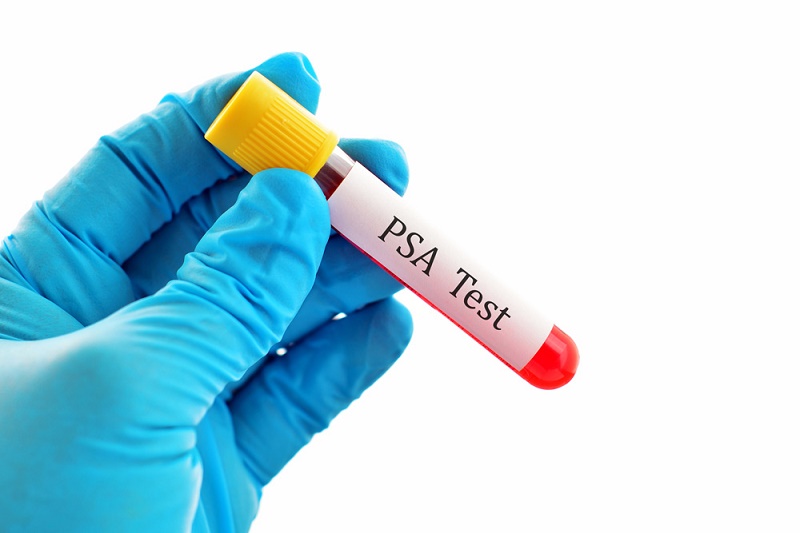 Простатспецифический антиген в крови: норма свободного и общего онкомаркера ПСА