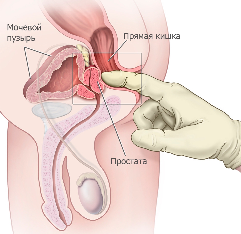 Где находится простата